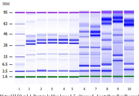 Use of microfluidic electrophoresis on chip in the analysis of milk 